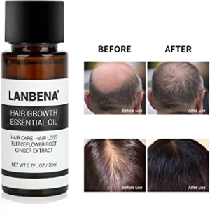 LANBENA Liquide pour le traitement de cheveux