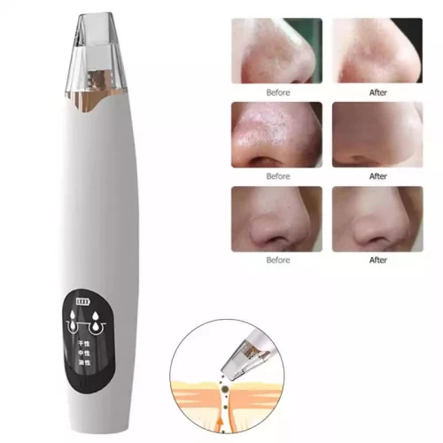 Aspirateur Visage Acne Points Noirs Dissolvant Points Noirs Nettoyage Visage